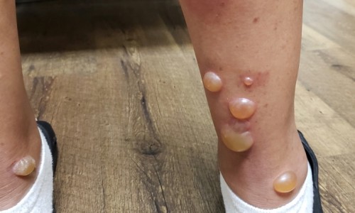 乌梅能不能吃-乌梅食用禁忌网 - 为你提供乌梅吃了有什么功效、乌梅食用禁忌是什么